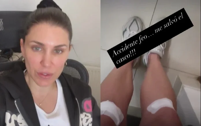 Wilma González hablando en sus stories de Instagram sobre el accidente que sufrió